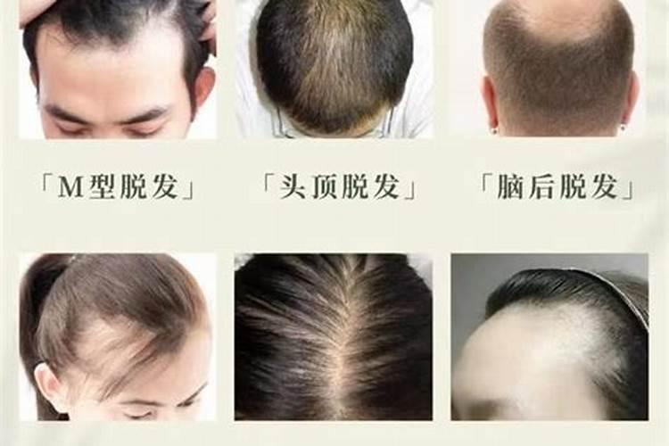 头发的风水是怎样的？