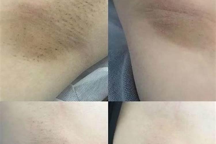 金诺寿是什么聊斋志异