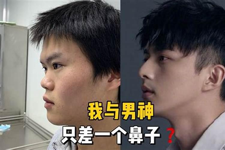 隆鼻影响运势吗,隆鼻可以改好运势吗