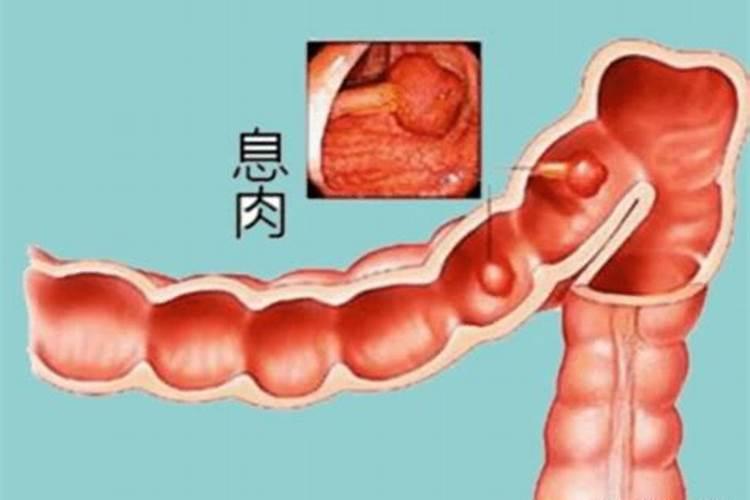 高人帮我分析一下八字,水旺缺土,怎么补救。