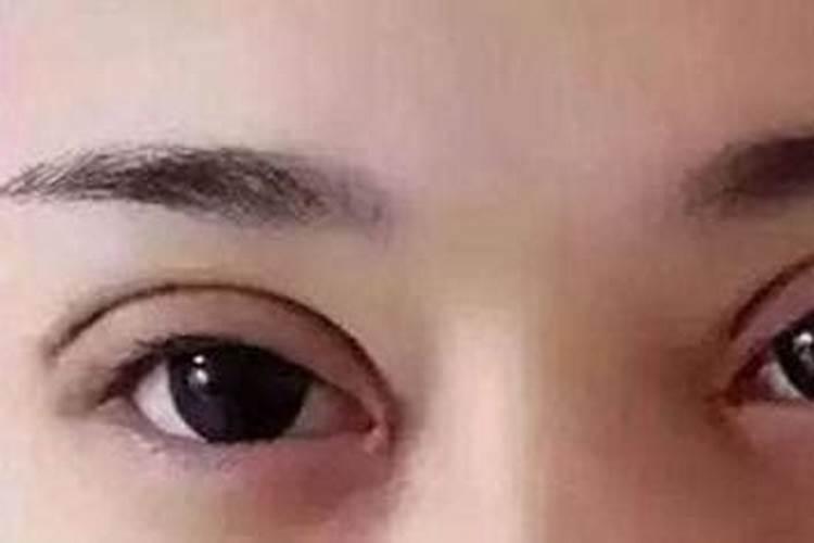 割双眼皮会影响运势吗