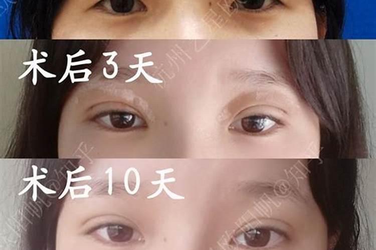 做眼睛影响财运吗,割双眼皮会带来财运吗