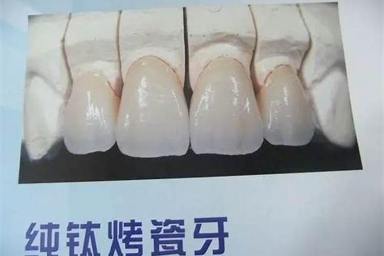 请问这个大门牙两边的牙齿很小在风水上有什么不好处。