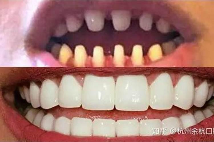梦见掉牙后长出新牙 求个风水师傅解释下 谢谢