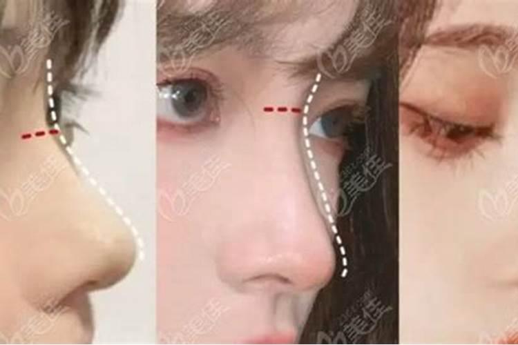 女人猪鼻子面相好吗