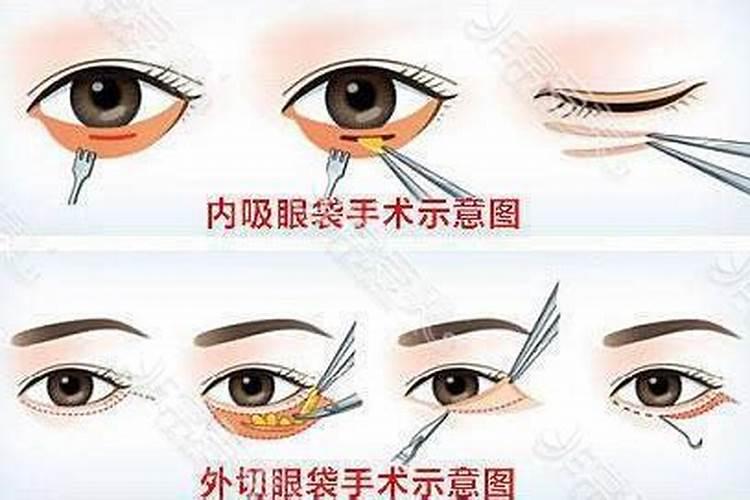眼袋在面部风水是什么