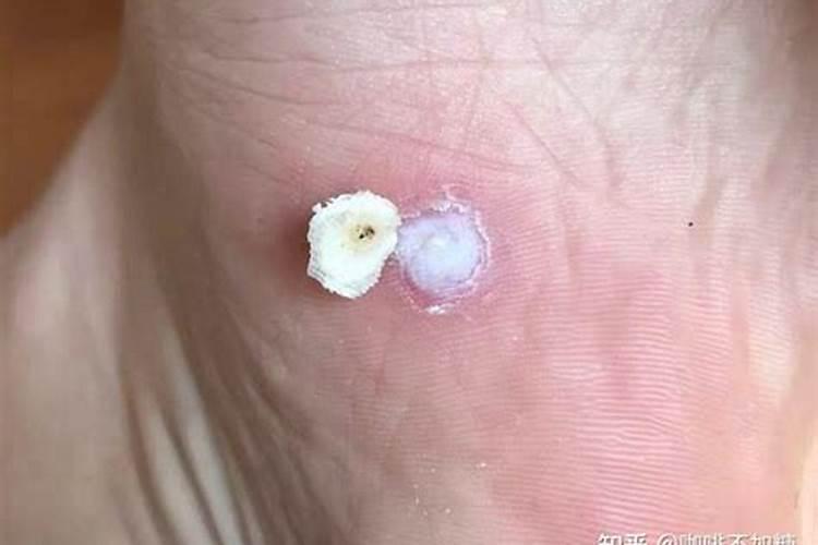 别墅绿化的施工？