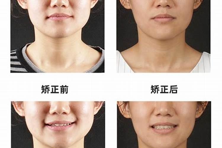 龅牙在风水上是什么意思