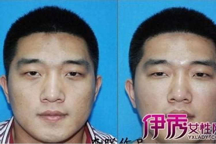 额头小的人