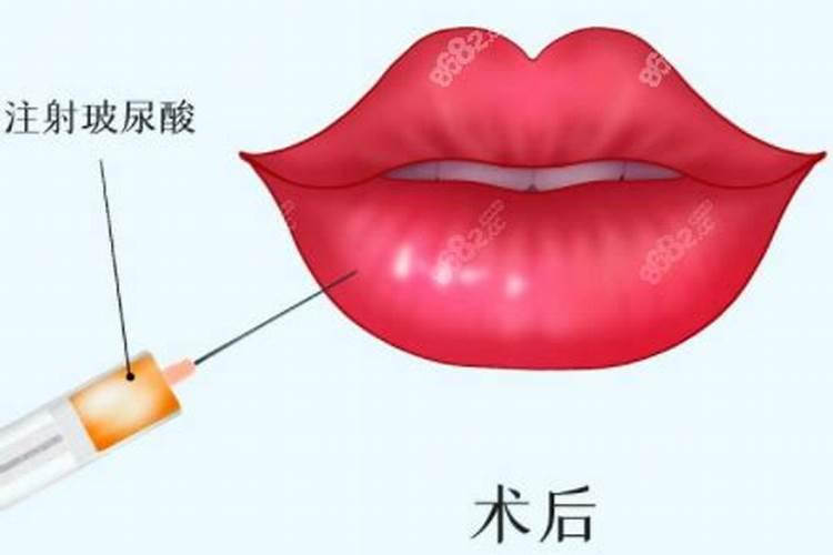 什么嘴唇最旺风水