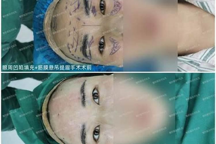 切眉影响运势吗,提眉或者切眉会不会影响一个人的运气