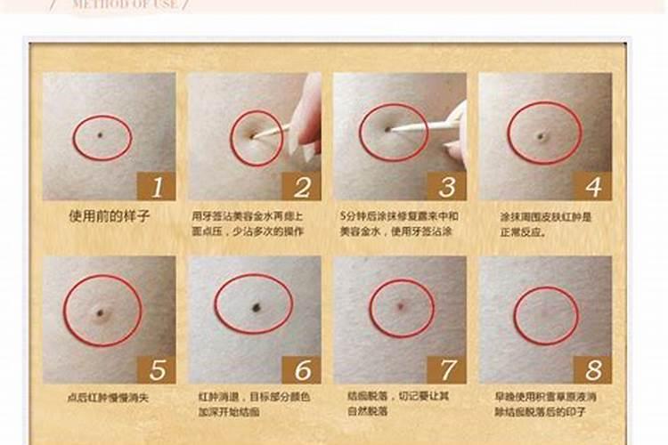 下巴长痦子好吗