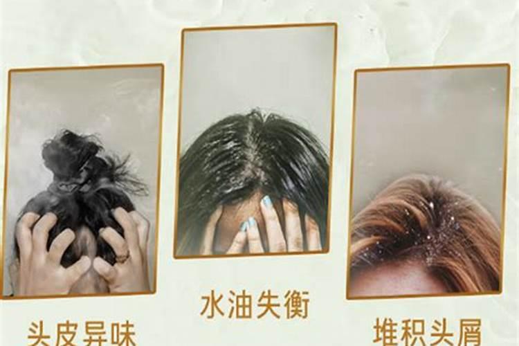 鸟屎掉衣服上怎么办？
