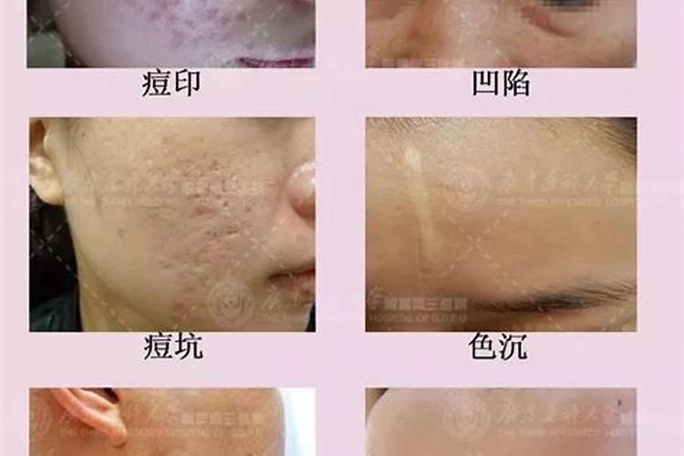 减肥期间便秘怎么办