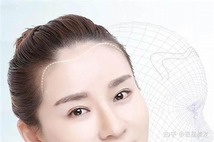 美人尖面相好不好