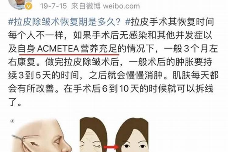 男明星也开始加入整容大军,你怎么看？