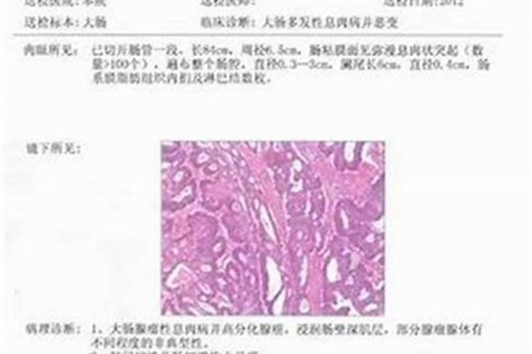 pvc护墙板铺在阳光房里面的墙上,因为是钢化玻璃顶,太阳晒在Pvc板上...