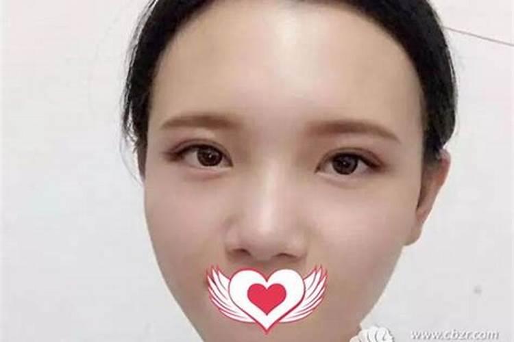 做双眼皮会影响屋里风水吗