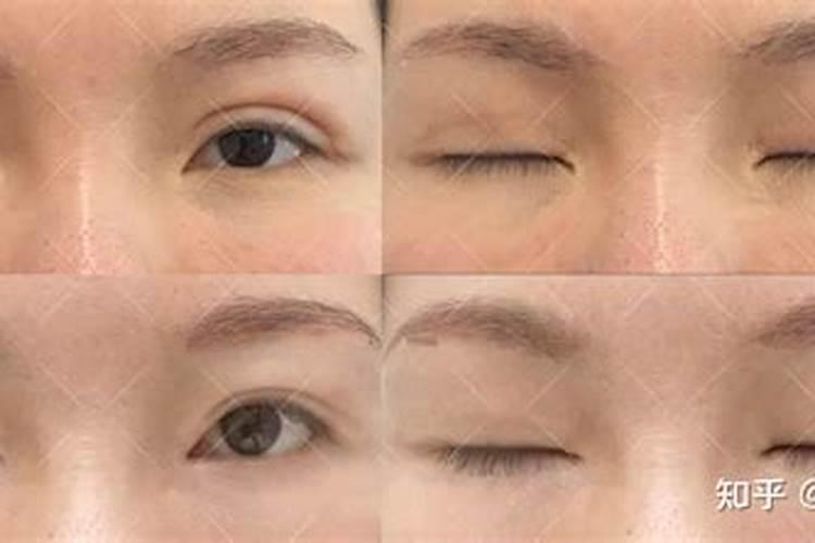 做了双眼皮的女孩在面相风水上有什么讲究
