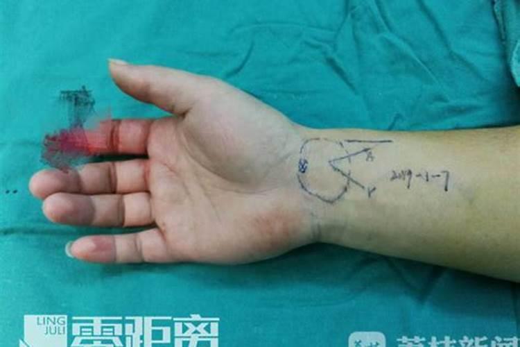 风水先生手指断了好不好？