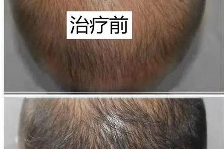 风水大师治脱发怎么样？